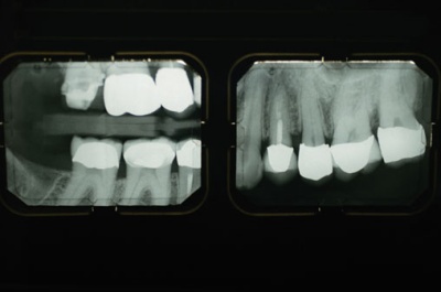 dentalxray.jpg